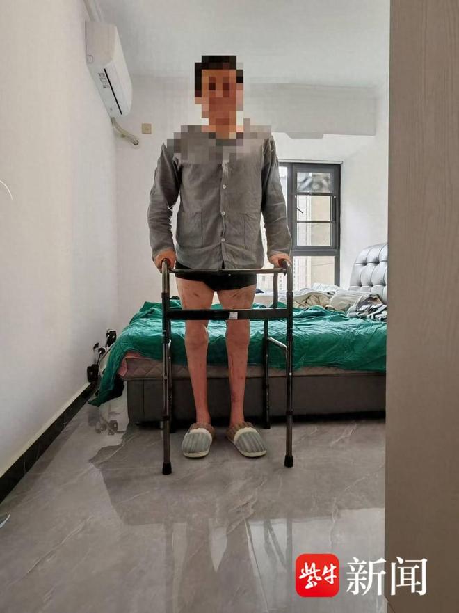 蓝狮平台注册：双腿被机器绞断近20个月后，他已经能借助助行器行走了！医生：远期有望脱离拐杖独立行走